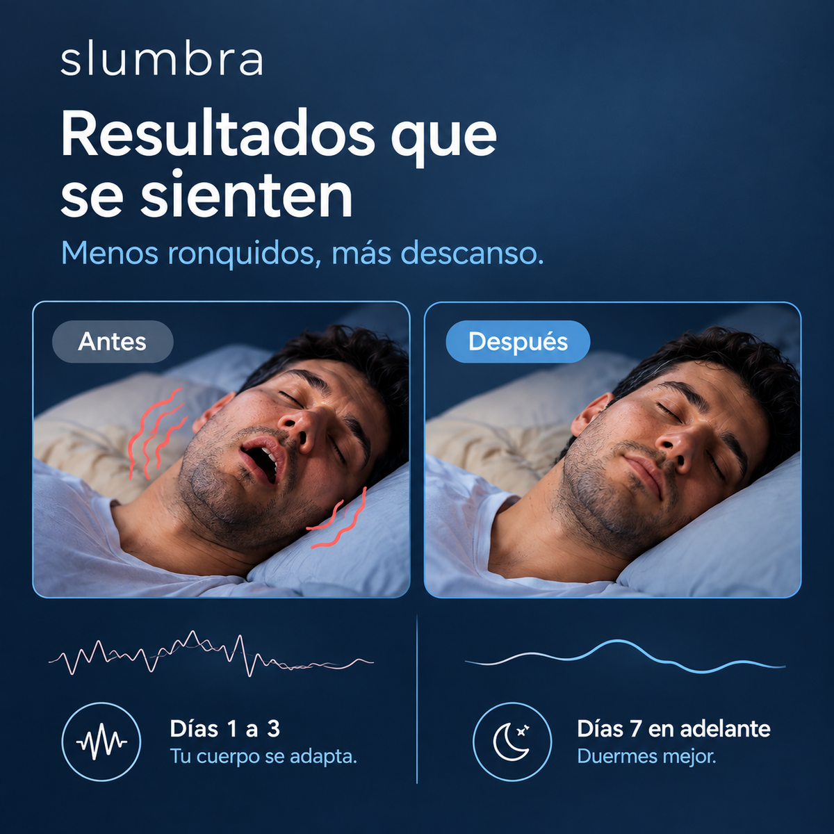 Dispositivo Inteligente Anti-Ronquidos