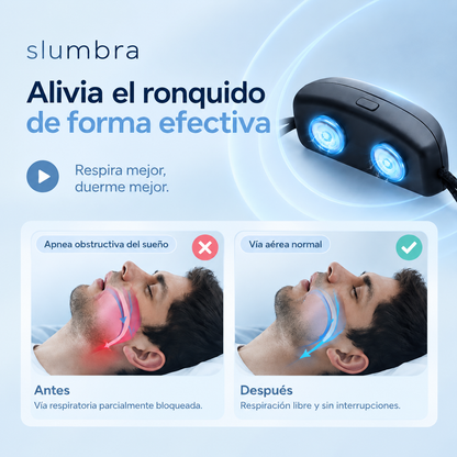 Dispositivo Inteligente Anti-Ronquidos